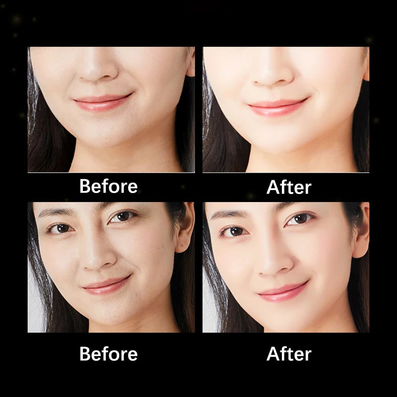5PCS anti Wrinkle Aging Face Sticker Eye Mask Forehead Neck Anti-Wrinkle Patches